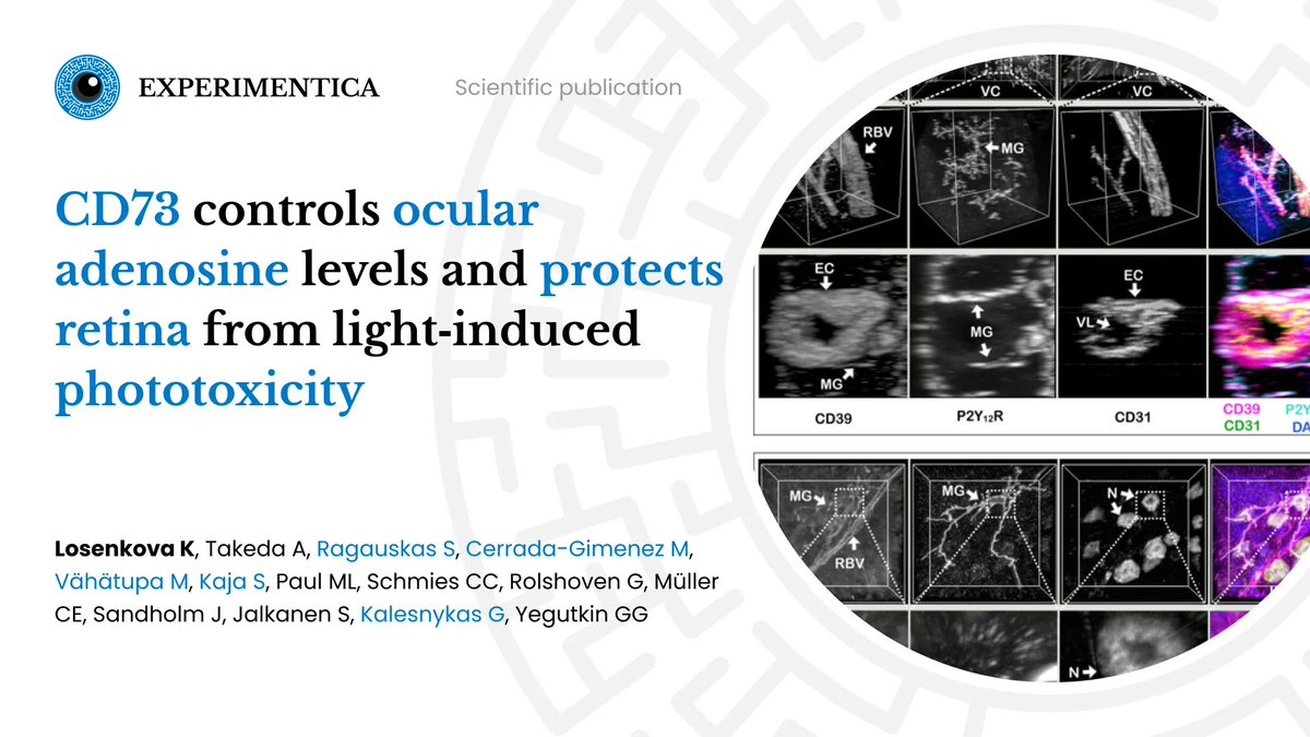 [PUBLICATION] CD73 controls ocular adenosine levels and protects retina from light-induced phototoxicity (Losenkova K et al.)
In Cellular and Molecular Life Sciences

Find out more:
buff.ly/3hIfZRP

#Experimentica #ScientificPublication #RetinalDegeneration