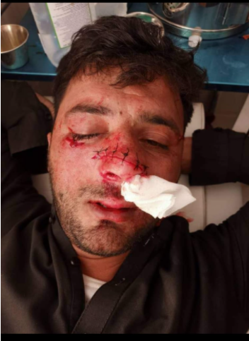 He was arrested from his home, beaten to almost death and his nose cut with a knife.

Only because he was a close ally of the British forces (infidel forces) in AFG.

#UK do more to protect our Interpreters, LECs, Partners &amp; SF units.

It is our moral obligation to protect them.