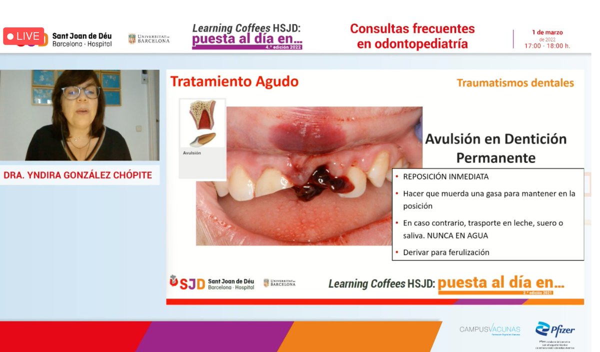 GatellAnna's tweet photo. Recomendaciones de @yndynet @SJDFormacion #learningcoffeeshsjd @carluaces EXTURSIÓN DIENTE🦷💥definitivo en leche desnatada y fria, con suero o saliva, NO CON AGUA https://t.co/3KkPfMjvoq