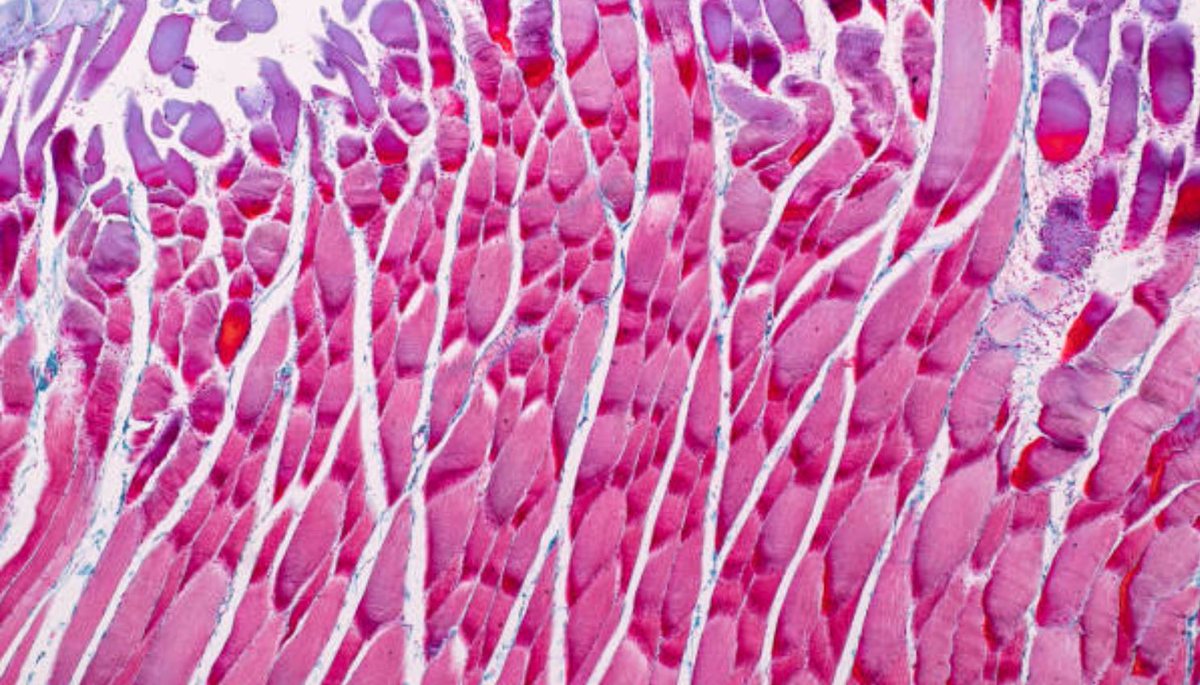 musclecellnews's tweet photo. Scientists combine an evolutionary perspective with physiological data to propose that IL-6’s context-dependent effects on metabolism reflect its adaptive role for short-term #MuscleTissue energy allocation. 🔋 

📍 https://t.co/zEYxvRXLPE https://t.co/Ozrysbo84v