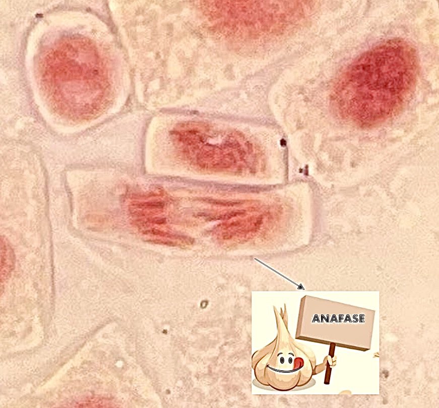yoljipe71's tweet photo. Yolanda Jiménez, os presenta la vida interior de un ajo
#practicamitosis 
#BiologiaGeneralNHyD21_22
#lamejoranafase
@VegaGEscudero https://t.co/bd3EPj01G0