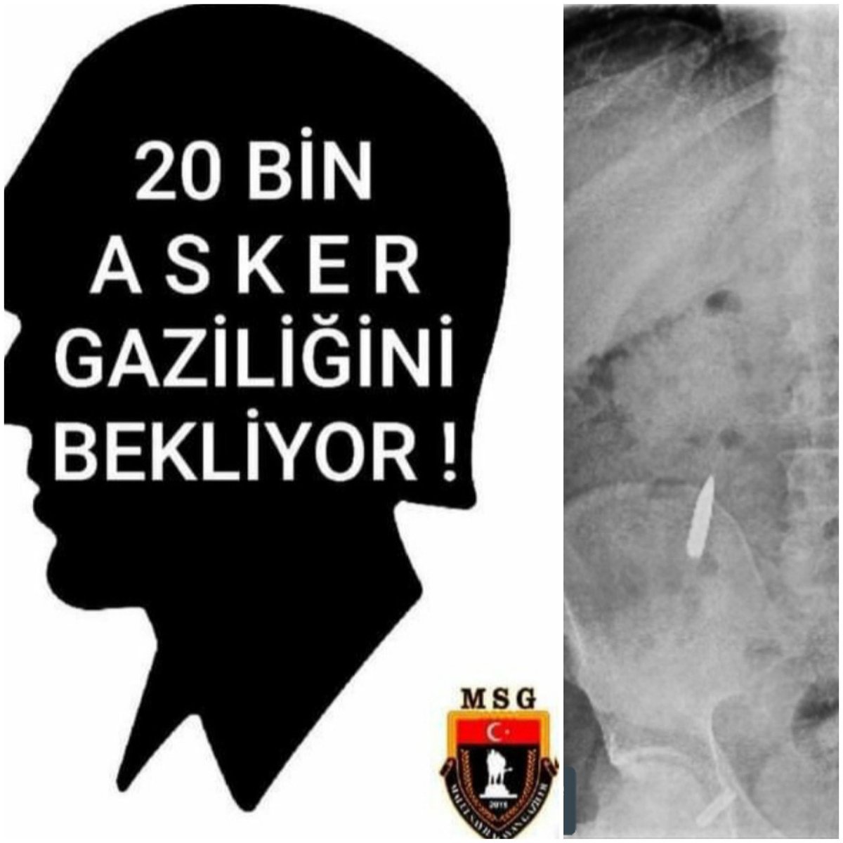 ERSINGOKCEE16's tweet photo. GaziYasası NedenBekliyor https://t.co/JSOO9RyygH