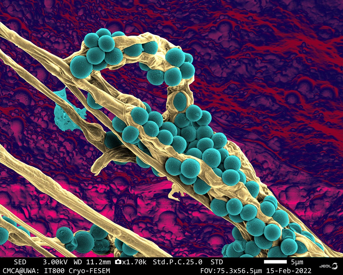 February Image Contest winner! "Blue Cheese Dreams" surface image of blue cheese highlighting the penicillium spp typical of these cheeses. CREDIT: Dr Jeremy Shaw and Dr Crystal Cooper, The University of Western Australia. Method: JEOL IT800 Cryo-FESEM / Leica VCT500 cryo-system.