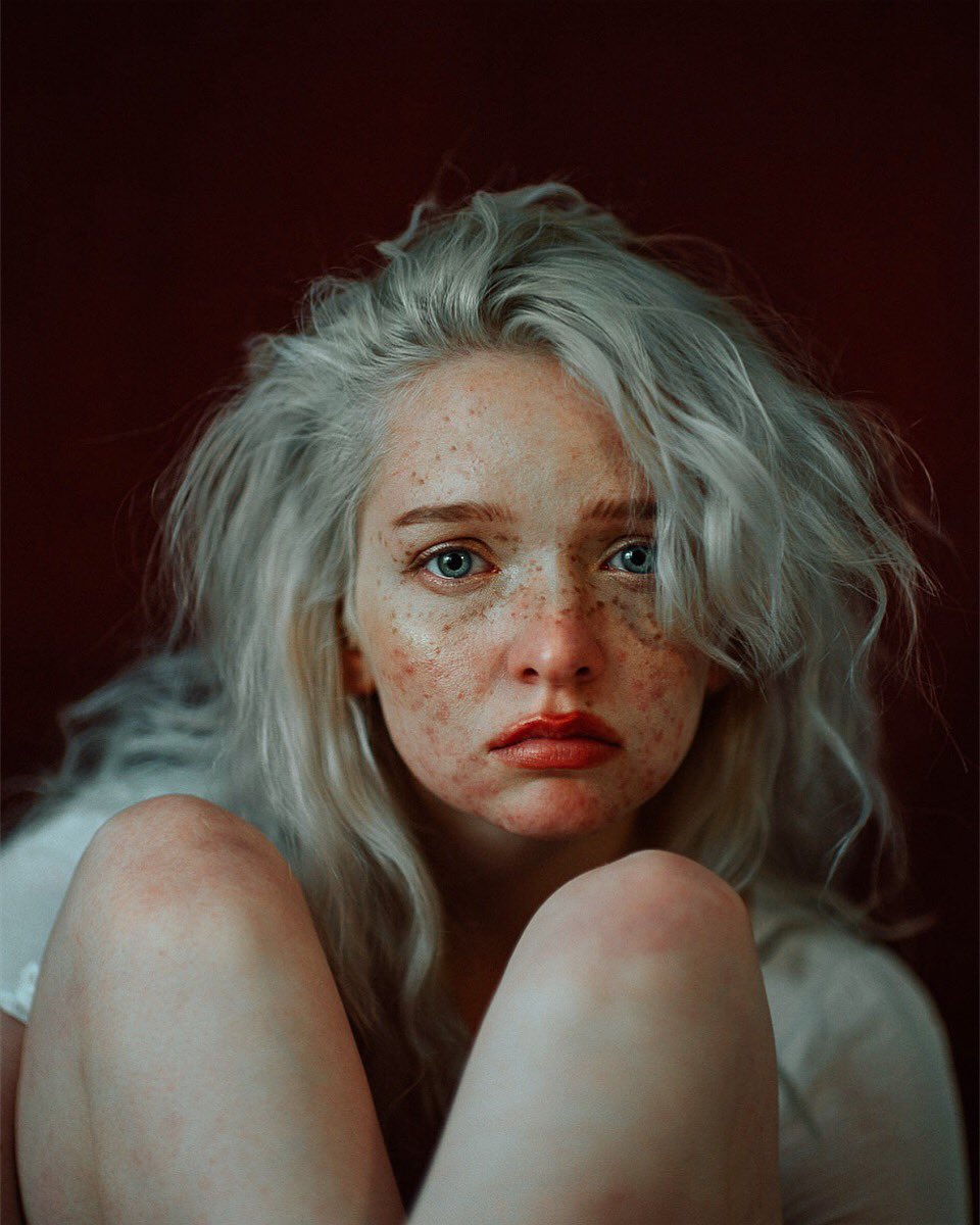 For years, freckles were edited out of portraits or seen as “less than”. Now, they are so popular that people draw them on. 

My idea for this portrait was to normalize something even more common than freckles, acne. 

#nftphotography #nftcommunity