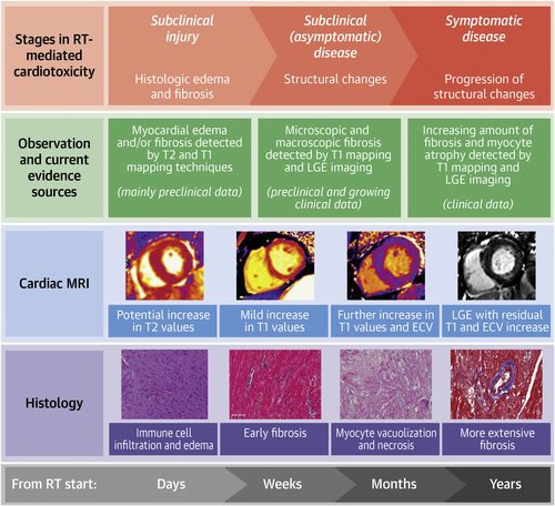 Assessing Silent Cardiotoxicity in Long-Term Lymphoma Survivors Treated With Radiotherapy 🫀☣️
bit.ly/3syvOR7

#CardioOncologia #CardioOnco #CardioOncology