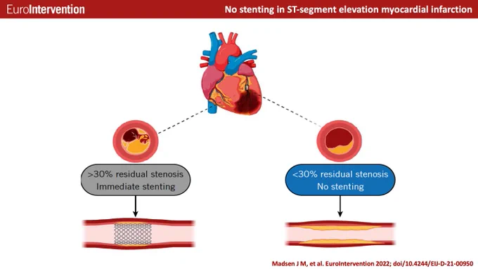 Image from EuroIntervention (@EuroInterventio)