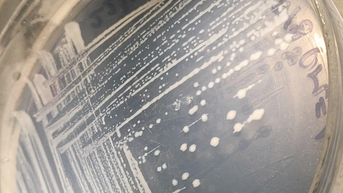 IibConicetUnmdp's tweet photo. Un grupo de investigadoras de nuestro instituto desarrollan una interesante investigación: "Aislaron una bacteria que come hidrocarburos y es capaz de producir bioplásticos": https://t.co/JtDVFaLldE https://t.co/WsRsWBi4rH