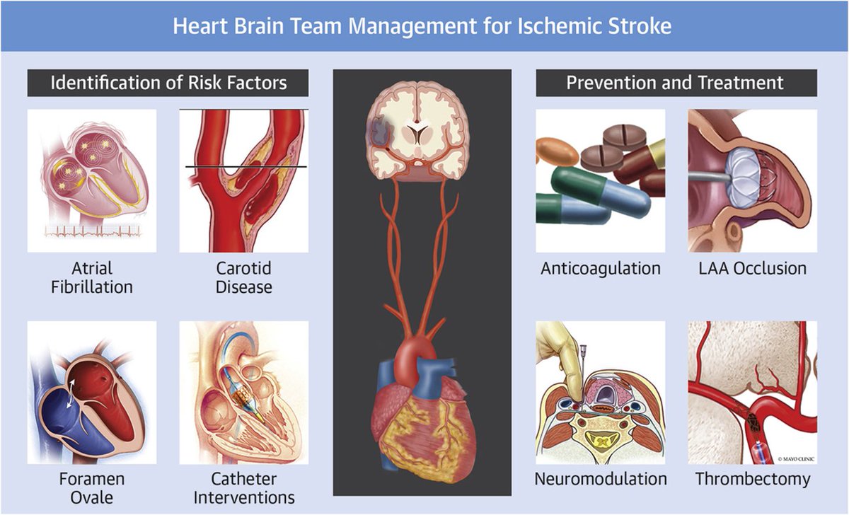 Tackling stroke requires effective🫀🧠 🤝 Our paper published in the inaugural issue of JACC Advances discuses the key role of the ‘Heart Brain Team’ in preventing & caring for ischemic stroke jacc.org/doi/full/10.10…