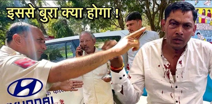 Ayubkha95583590's tweet photo. Shame on you hyundai. 
You are not able to resolve problem of your customers and then beating them rudely with the help of your employees😕. 
Wishing a speedy recovery for you ajit bhai and waiting for the reply of hyundai  officials on this matter. 
#justiceforajit https://t.co/nMRgNuZF0p