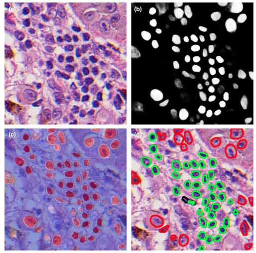 Pigment Cell & Melanoma Research (@pcmr_wiley) on Twitter photo #freeaccess
#Artificial #intelligence (AI) applications in #melanoma detection, prognosis, and treatment are rapidly developing. Here, Stiff et al <a href="/metrohealthCLE/">MetroHealth</a> discuss contemporary investigational applications a& challenges of #AI in #melanoma:
onlinelibrary.wiley.com/doi/10.1111/pc… #freeaccess
#Artificial #intelligence (AI) applications in #melanoma detection, prognosis, and treatment are rapidly developing. Here, Stiff et al <a href="/metrohealthCLE/">MetroHealth</a> discuss contemporary investigational applications a& challenges of #AI in #melanoma:
onlinelibrary.wiley.com/doi/10.1111/pc…