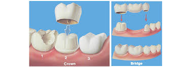nV_Violet's tweet photo. https://t.co/CFschODde0

https://t.co/ZS43pkaHDQ

https://t.co/XOwSAyF71G

cosmetic dentistry auburn https://t.co/AmXgzuINvZ