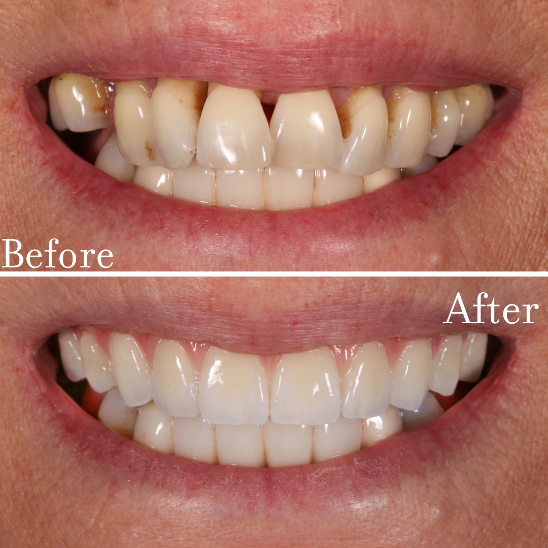 UADChicago's tweet photo. UAD Smile makeover! Follow our #instagram for more! 😀 https://t.co/lrUh1PeMdU