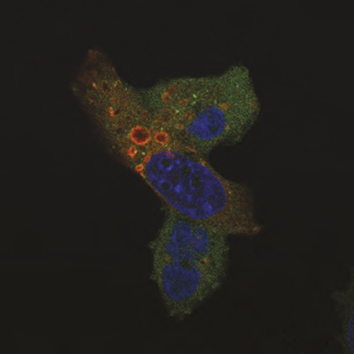 J Cell Science (@j_cell_sci) on Twitter photo Søreng, Pankiv, Simonsen &co <a href="/simonsen_lab/">Simonsen Lab</a> <a href="/CanCell_UiO/">Centre for Cancer Cell Reprogramming</a> <a href="/UniOslo/">Universitetet i Oslo</a> provide insights into how ALFY regulates cell migration; more in our Research highlight: ow.ly/3h4f50IitIB Søreng, Pankiv, Simonsen &co <a href="/simonsen_lab/">Simonsen Lab</a> <a href="/CanCell_UiO/">Centre for Cancer Cell Reprogramming</a> <a href="/UniOslo/">Universitetet i Oslo</a> provide insights into how ALFY regulates cell migration; more in our Research highlight: ow.ly/3h4f50IitIB