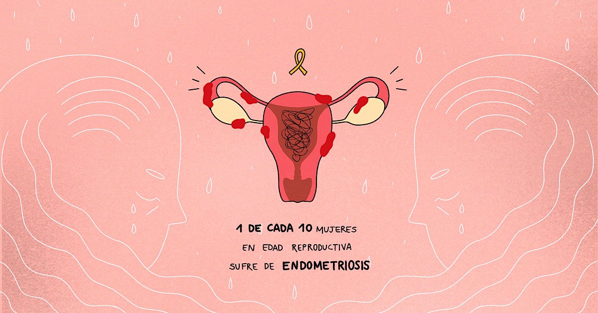 Blu3Kai's tweet photo. Hoy es el día internacional de la ENDOMETRIOSIS,  enfermedad que sufro desde el comienzo de mi edad fértil. Es necesario darle visibilidad a esta enfermedad silenciada a causa de normalizar los dolores de regla y el tabú que esta supone todavía a día de hoy. https://t.co/REdfe314Rg