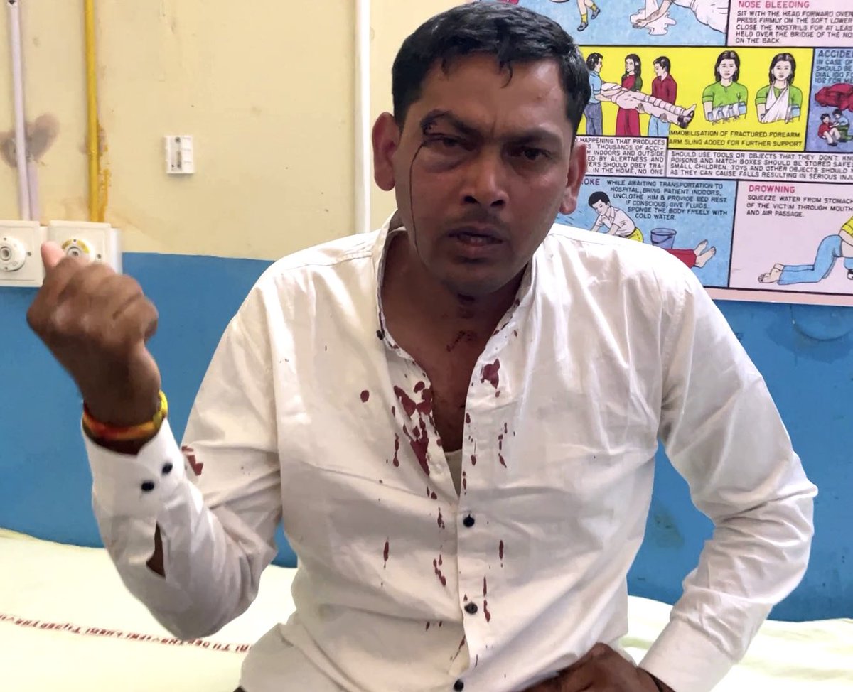 Anand_9113's tweet photo. Shame on you @HyundaiIndia . Your customer are being beaten by your service centres.
This is the kind of service you provide to us Indians. 
#shameonhyundai #justiceforajit https://t.co/OL0UuZvbC8