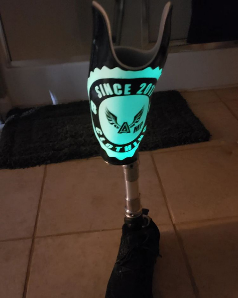 FourrouxPro's tweet photo. Check out this awesome #glowinthedark #prosthesis that one of our long-time #ATL patients, Mr. Wiggins, requested!
#loveit! 👍🦾
#amputeelife #amputeestyle #Fourroux #buildingrelationshipsforlife https://t.co/wVUGgKGlZl