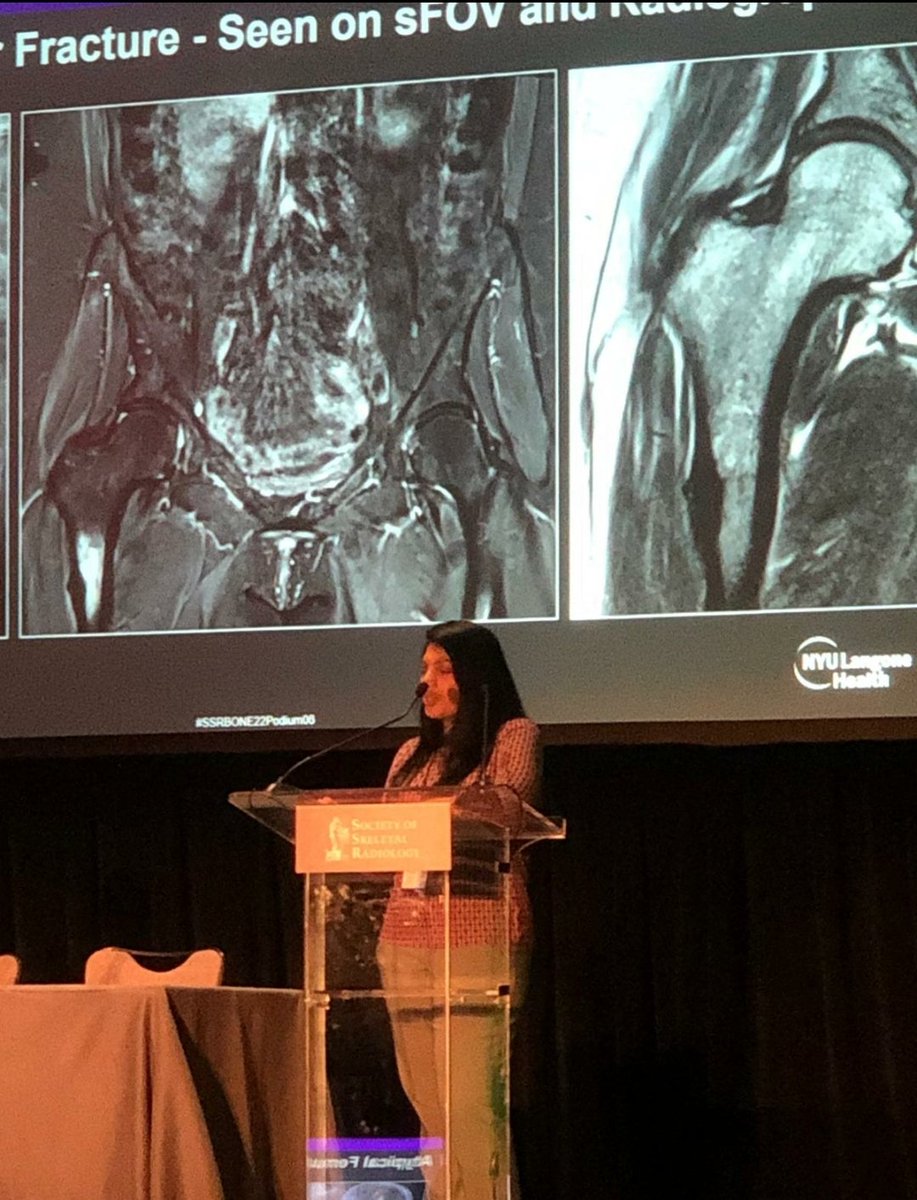 SirishaKoneru2's tweet photo. My first major conference presentation - Change how we image our hip studies.Thank you 
@JanFritzMSK  for being an amazing mentor. Shout out to all my colleagues.

#SSR2022 #coronado 
#NYU_MSKradiology #ILookLikeARadiologist #RadXX #WomenInMedicine  #diversity  #ladiologist https://t.co/4okMxMoczr