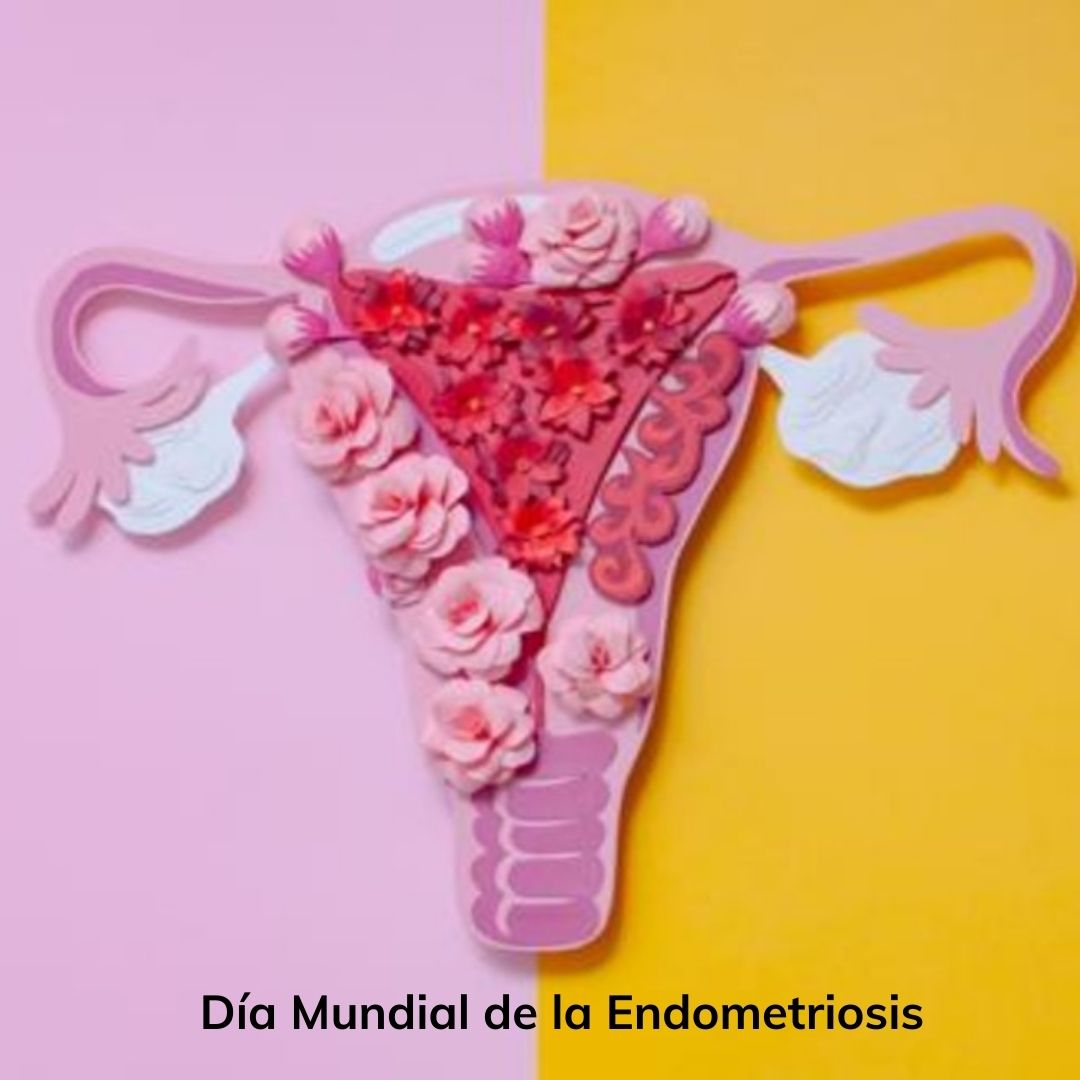 Hoy conmemoramos el Día Mundial de la Endometriosis👩‍💼

El diagnóstico temprano de esta enfermedad es fundamental, a fin de evitar complicaciones en el tiempo por medio de un tratamiento oportuno.☝️

.
.
#fundanica #fundanicavalencia  #diamundialdelaendiometriosis