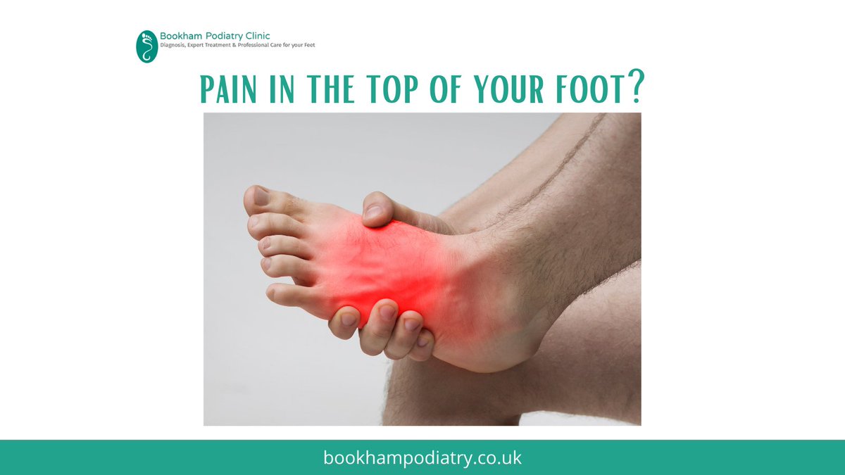 Suffering with pain in the top of your foot? One common cause could be extensor tendonitis – which can be caused by overuse or tight fitting shoes. You may feel a pain where your shoelaces are & possibly visible swelling or bump. Any trouble, get in touch to see how we can help.