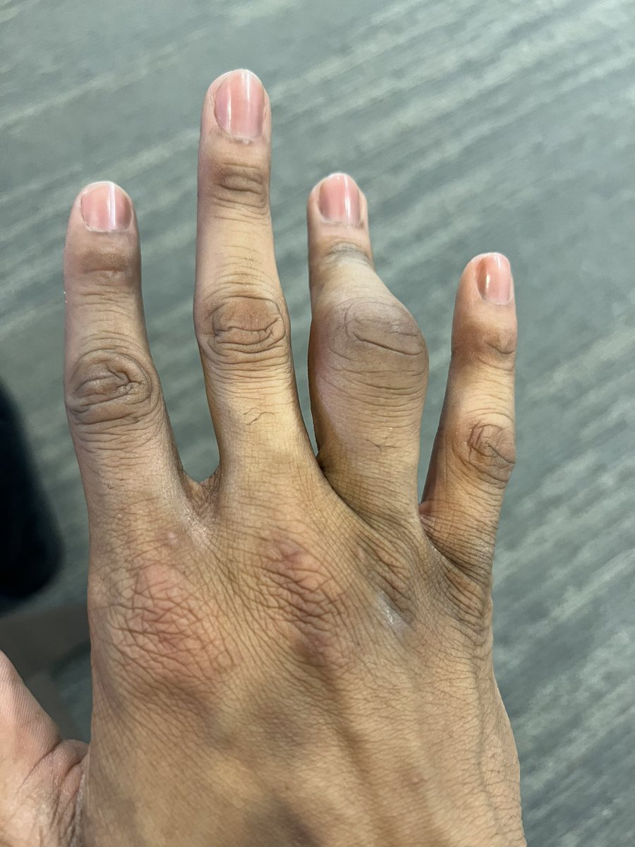 TheDunkCentral's tweet photo. John Collins’ finger 😳

(Via @JameelahJNBA ) https://t.co/S5Q23xHECS