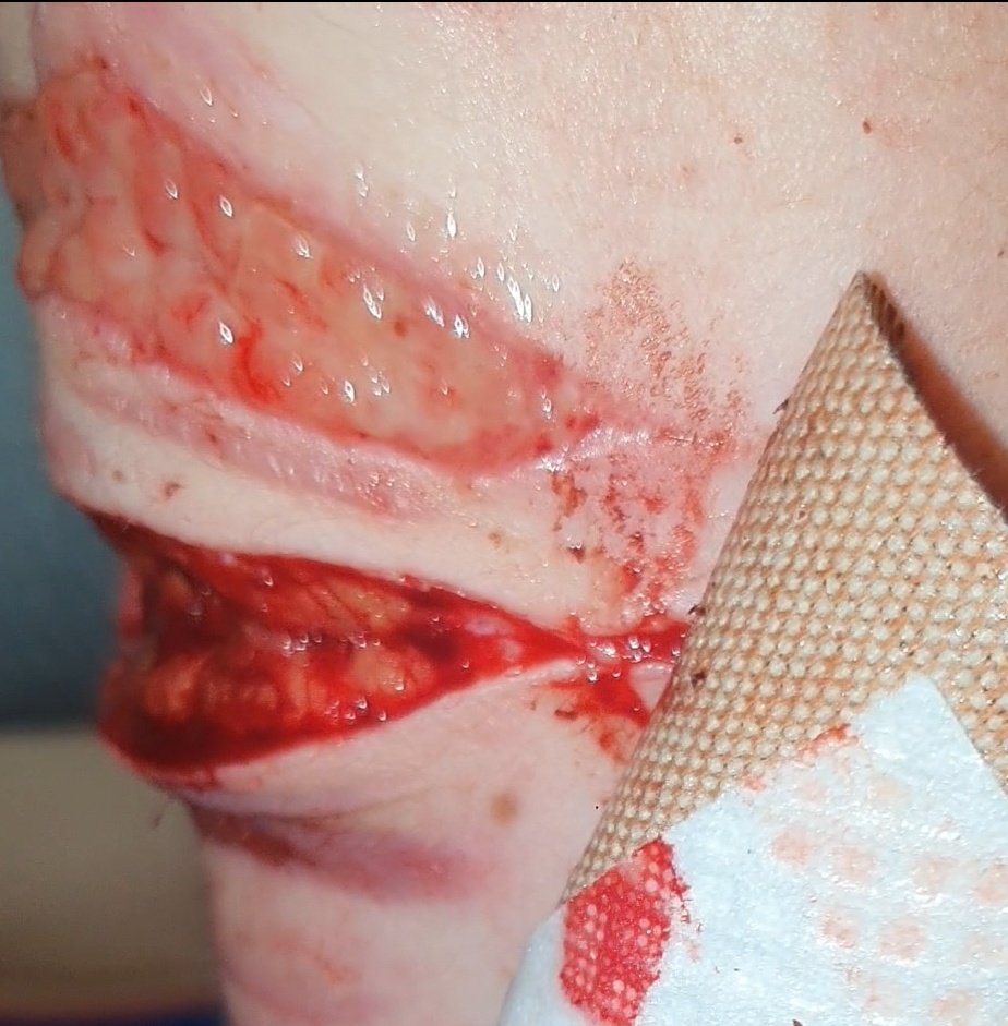 lavalampbl00d's tweet photo. couldn't get many good pics last night cuz I had no privacy
-
-
beanstwt barcodetwt yeettwt sliceytwt catscratchtwt armgillstwt ouchietwt styrotwt https://t.co/aU08bhYvf8
