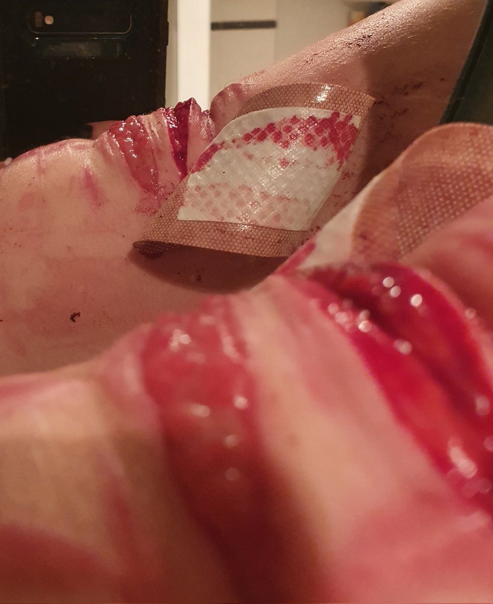 lavalampbl00d's tweet photo. couldn't get many good pics last night cuz I had no privacy
-
-
beanstwt barcodetwt yeettwt sliceytwt catscratchtwt armgillstwt ouchietwt styrotwt https://t.co/aU08bhYvf8