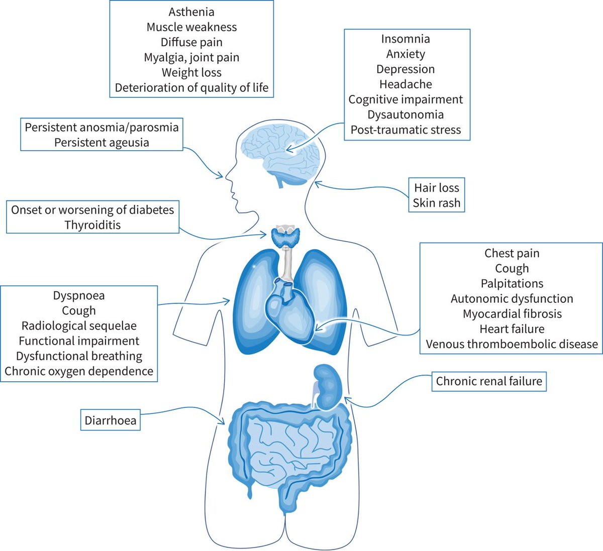 Given the millions of patients infected with #SARSCoV2 worldwide and the need for multidisciplinary management of the chronic complications, post-acute #COVID19 syndrome will be a major issue for various healthcare providers in the coming months. bit.ly/3lBJuXu