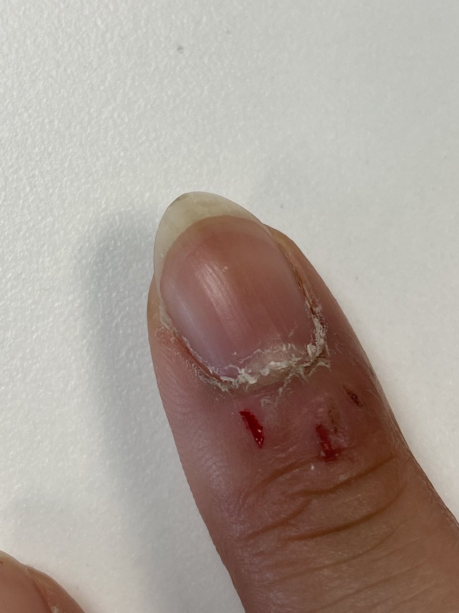 grlalyssa's tweet photo. Like girl what is this. I don’t even know how to fix her I don’t have a nail drill https://t.co/eJUIrn90Th