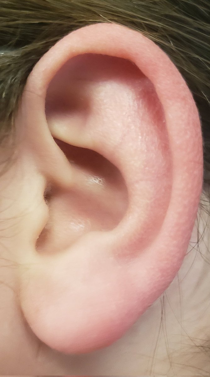 neapian's tweet photo. Ear Ear Ear Ear Ear Ear https://t.co/gTb5S70sY5