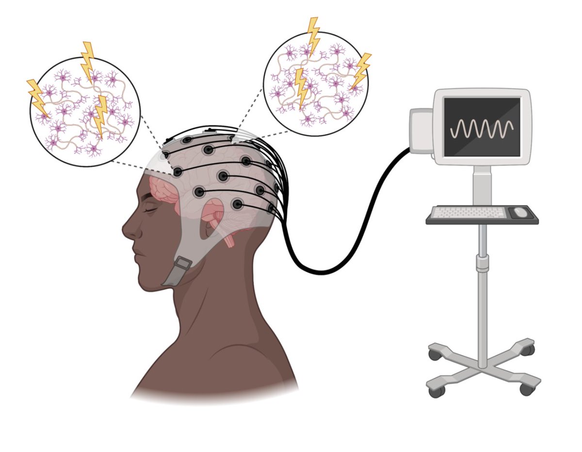 SinaiBrain's tweet image. 🤔EVER WONDER, Mmm, "Can you measure voltage changes in the #brain?". You can! These measurements are called "Brain Waves". LEARN EVEN MORE by reading @fink_alexandra's #BrainBlog "What Are Brain Waves?"👉mindatsinai.com/mindsblog/what…
🧠#BrainAwarenessWeek @dana_fdn @GradSchoolSinai