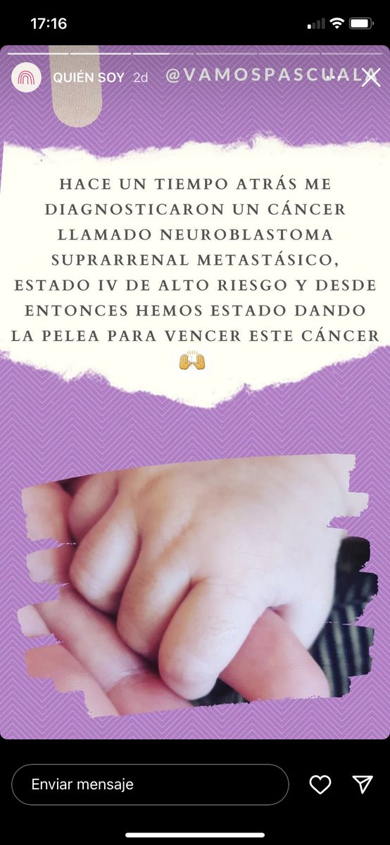 lanico_86's tweet photo. CAMPAÑA @vamospascuala @KenaAguayo @josebianchi Pascuala tiene 1 año 3 meses, ha sido diagnosticada con un cáncer cuyo tratamiento cuesta $246.000.000 y hay que traerlo de USA. Comparto información para que todos ayudemos a la Pascui. RT y que llegue a todo el mundo! https://t.co/bTVXGerxTa