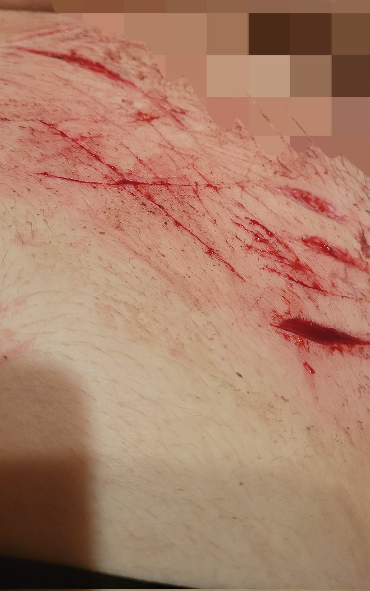 eclipse19085409's tweet photo. dysphoria makes one do crazy shit. shtwt styrotwt beanstwt https://t.co/3p2vnGvvH8