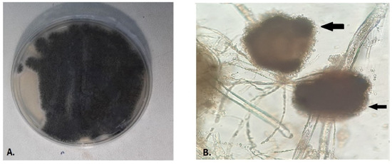 antibioticsmdpi's tweet photo. #EditorChoiceArticle
Possible COVID-19-Associated Pulmonary Aspergillosis due to Aspergillus niger in Greece by Dr. Athanasios Tsakris et al. from @uoaofficial 
👉https://t.co/xr3PG1Uare https://t.co/AbKEKRX7p1