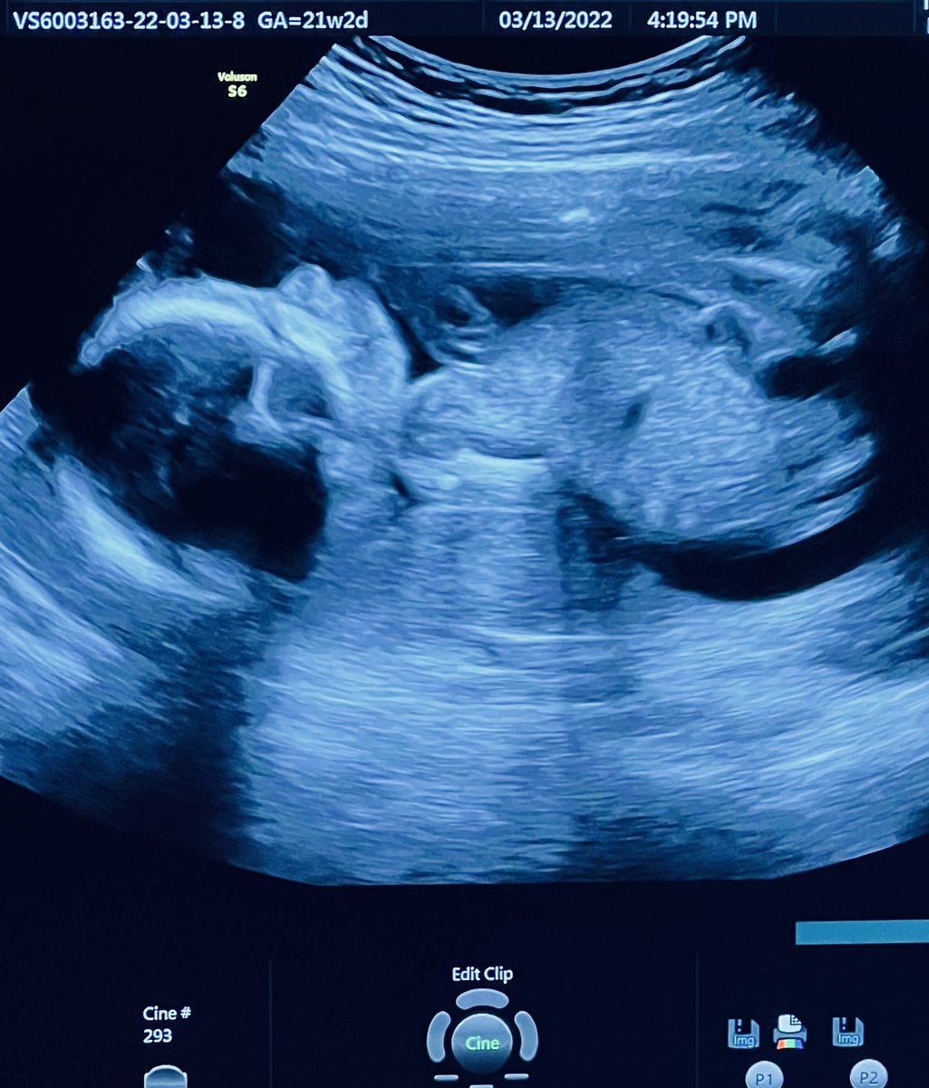 JGGERMONO's tweet photo. FIRST BABY 🤍 Can't wait to see you anak! 🤍 https://t.co/H8QjJmdVsm