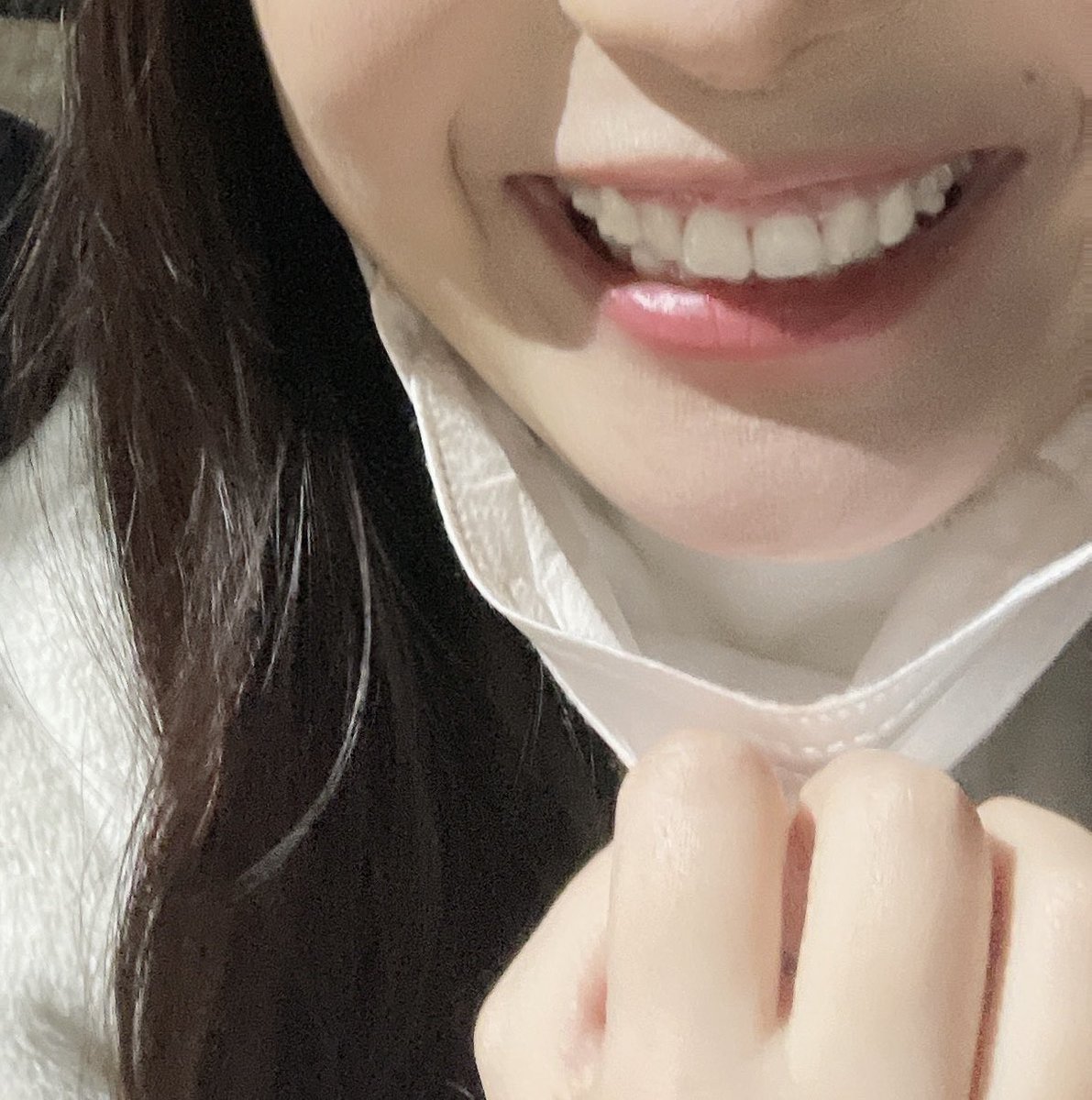 ttvi_i's tweet photo. 友達と撮った写真、自然と歯見せて笑えてる事に感動する…笑
今月末でインビザ1年経つけど、あと半分くらい！！頑張ろ！🥳 https://t.co/bSy2kds9x4