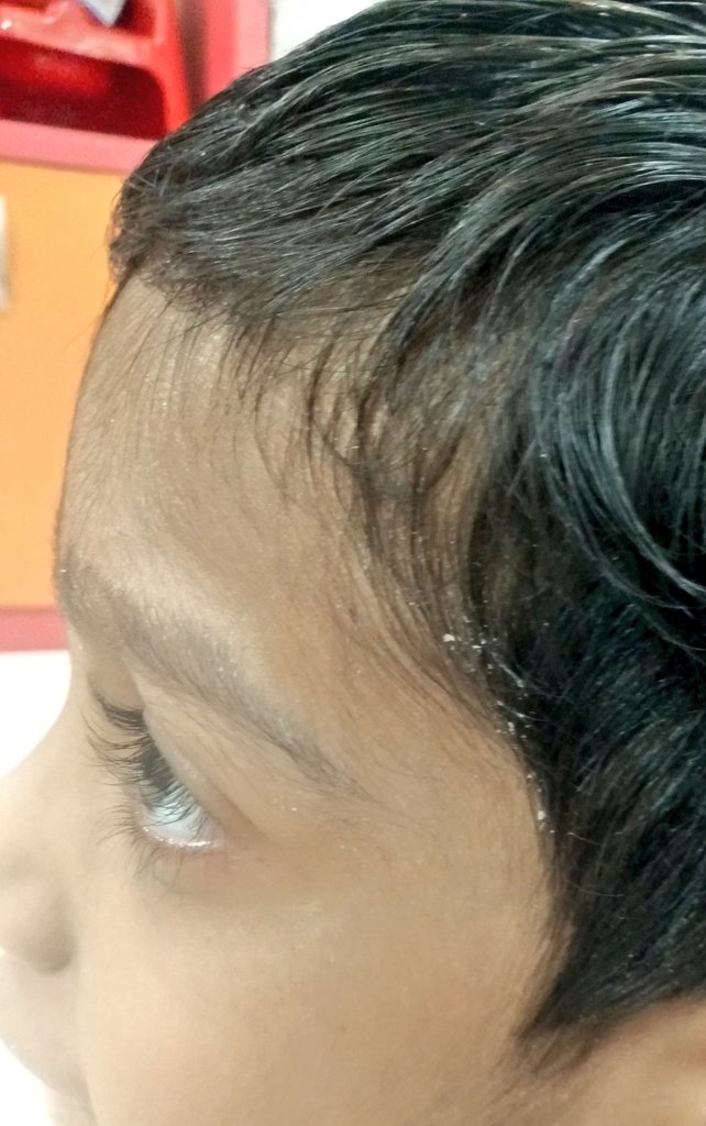 vihaan_cfindia's tweet photo. SaltyBoy 🙃
#vihaan #cysticfibrosis #saltylife #LivingLifeWithCysticFibrosis #CfLife #summers #saltyskin #GenticCondition #RareDisease https://t.co/VOzPsQCIH3