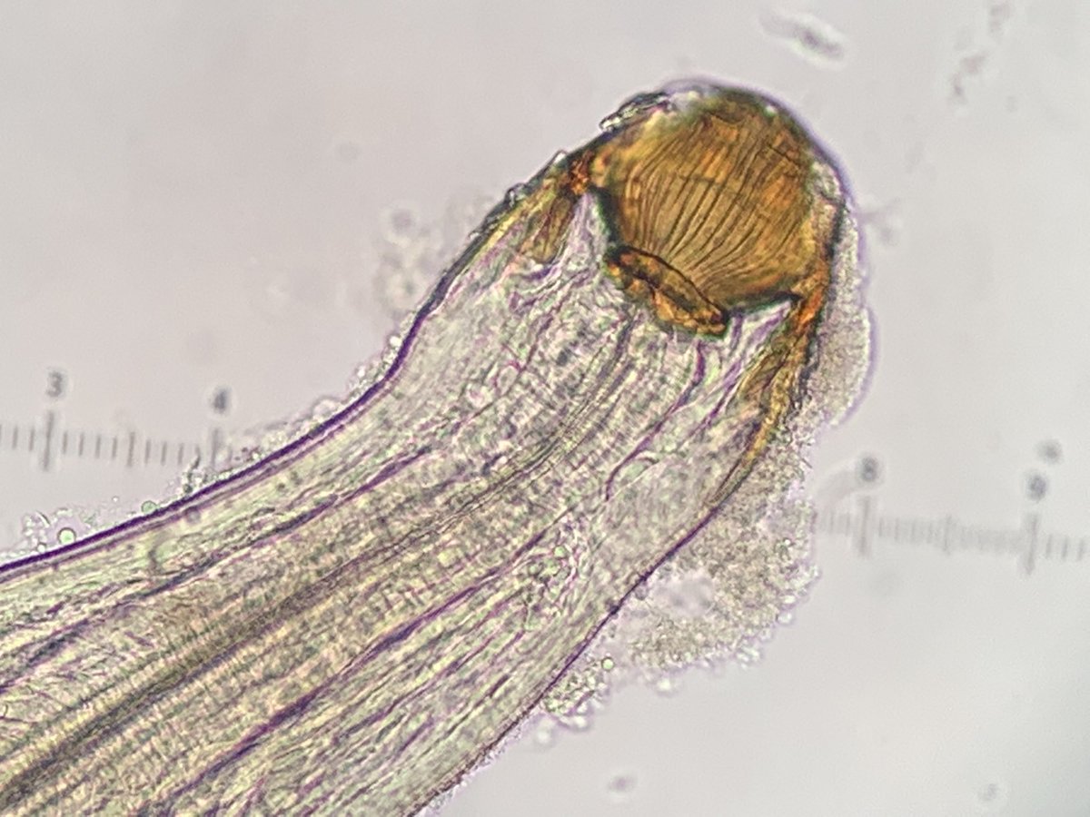 UTParasitePulse's tweet photo. Parasitic nematode freshwater fish aquarium…what is your diagnosis? https://t.co/wVbCN7yRSj