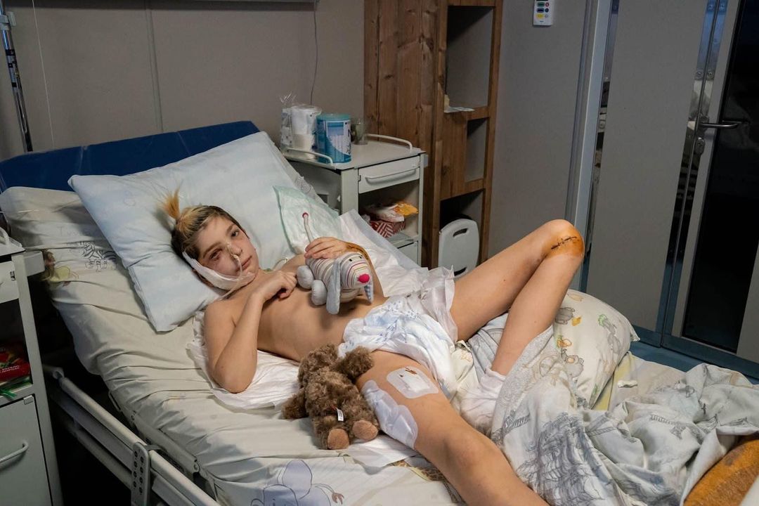 This is Volodymyr. He is 12 years old. He suffered from shelling by the #russian troops while fleeing #Kyiv.
#putin's bastards hit in their car. Volodymyr is now in hospital. He was lucky. He is alive. But his younger brother and father were killed.
#russianWarCrimes