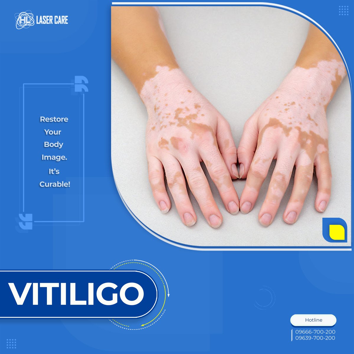 hllasercare tweet media