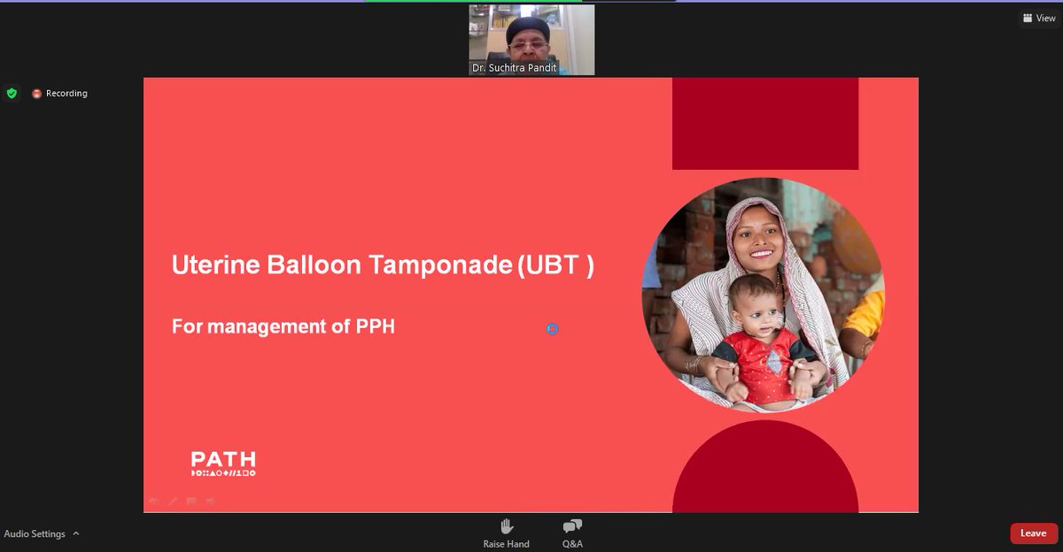 Thank you for joining in to hear insights from Dr. Suchitra Pandit on her expertise on the management of #postpartumhemorrhage along with the live demonstration of #sinapi's promising #UBT innovation.
Stay tuned for more such updates from upcoming webinars soon! 
<a href="/PATHtweets/">PATH</a>