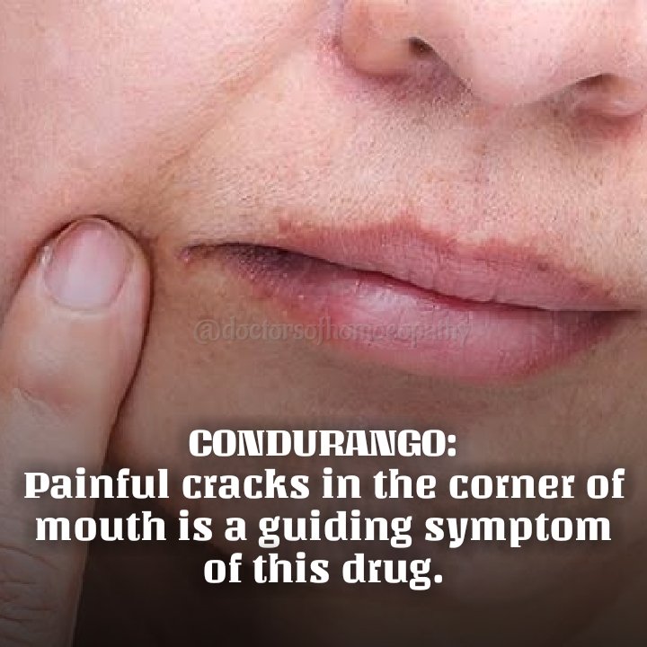 DOHomoeopathy's tweet photo. #Condurango https://t.co/mjgHLsVqHt