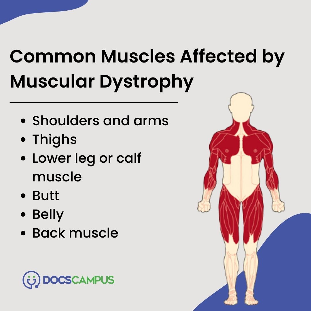 Through Which Mechanism Is Duchenne Muscular Dystrophy Acquired Duchenne Muscular Dystrophy Legs
