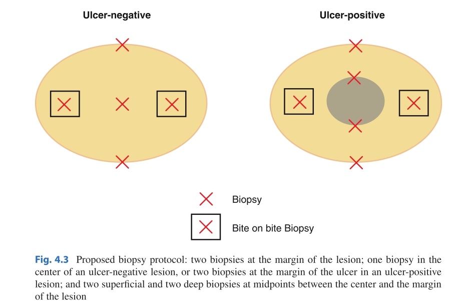 TeamSurgery (@teamsurgery247) on Twitter photo Proposed biopsy protocol in Gastric cancer (Filippo Catalano et al) #SoMe4Surgery
<a href="/MDAndersonNews/">MD Anderson Cancer Center</a>
<a href="/Manishbhandare4/">Manish S Bhandare</a>
<a href="/surgery_cancer/">GastroIntestinal Cancer Surgery</a>
<a href="/drkeithsiau/">Keith Siau</a>
<a href="/gvraoaig/">Dr G V Rao</a>
<a href="/DrJonnys/">Dr. Johnny Stewart. MD , FRCSC / RMC, CAF</a>
<a href="/DrThawaba/">Abdullah Thawaba</a>
<a href="/pferrada1/">Paula Ferrada MD FACS FCCM MAMSE</a> Proposed biopsy protocol in Gastric cancer (Filippo Catalano et al) #SoMe4Surgery
<a href="/MDAndersonNews/">MD Anderson Cancer Center</a>
<a href="/Manishbhandare4/">Manish S Bhandare</a>
<a href="/surgery_cancer/">GastroIntestinal Cancer Surgery</a>
<a href="/drkeithsiau/">Keith Siau</a>
<a href="/gvraoaig/">Dr G V Rao</a>
<a href="/DrJonnys/">Dr. Johnny Stewart. MD , FRCSC / RMC, CAF</a>
<a href="/DrThawaba/">Abdullah Thawaba</a>
<a href="/pferrada1/">Paula Ferrada MD FACS FCCM MAMSE</a>