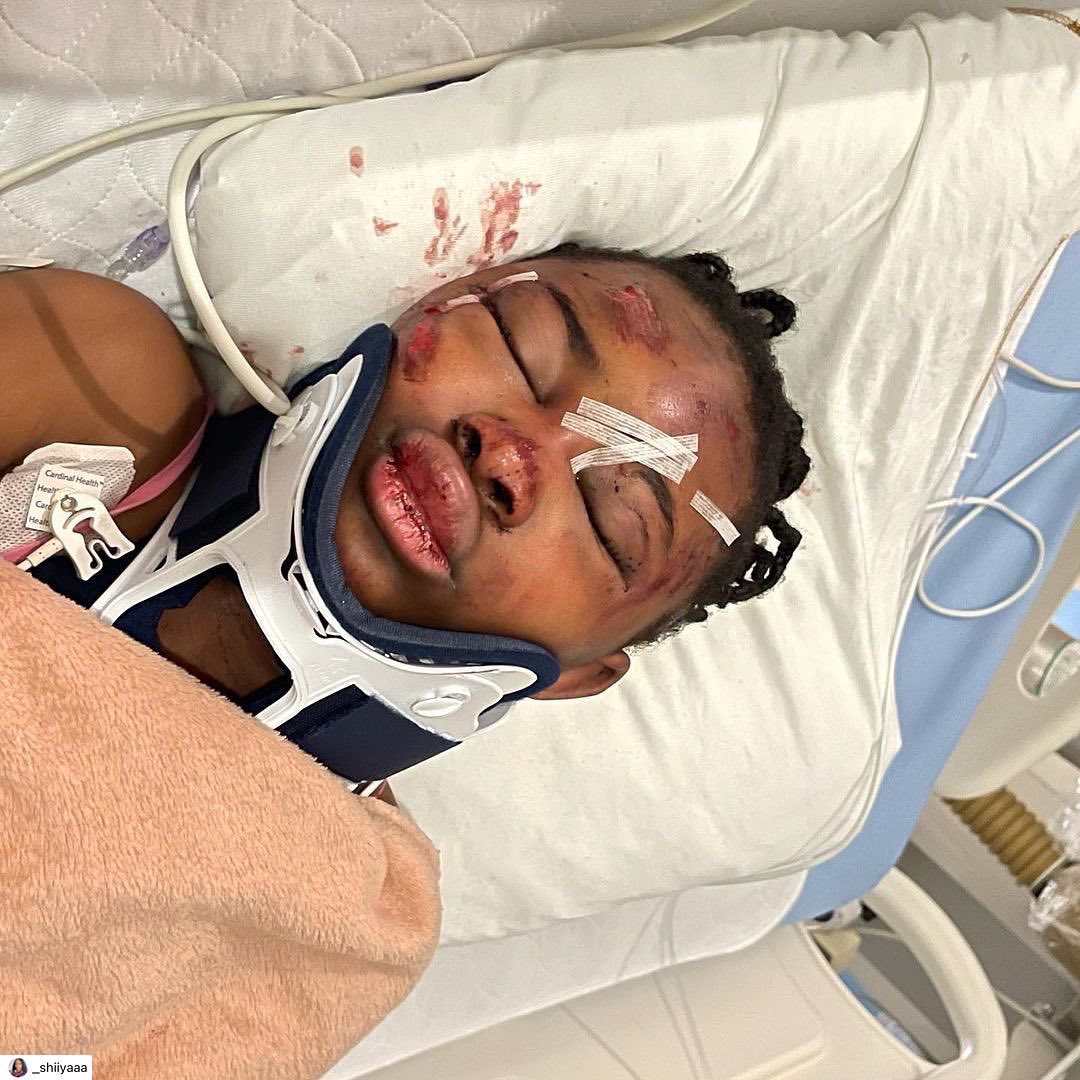 renzel514's tweet photo. Alicia, Fillette de 10 ans attaquée par un homme raciste de 40 ans au retour de l’école dans la rue  #justicepouralicia #blm #polqc @guyalepage @kick1972 @CharetteB @Val_Plante https://t.co/CfyUZYke2D