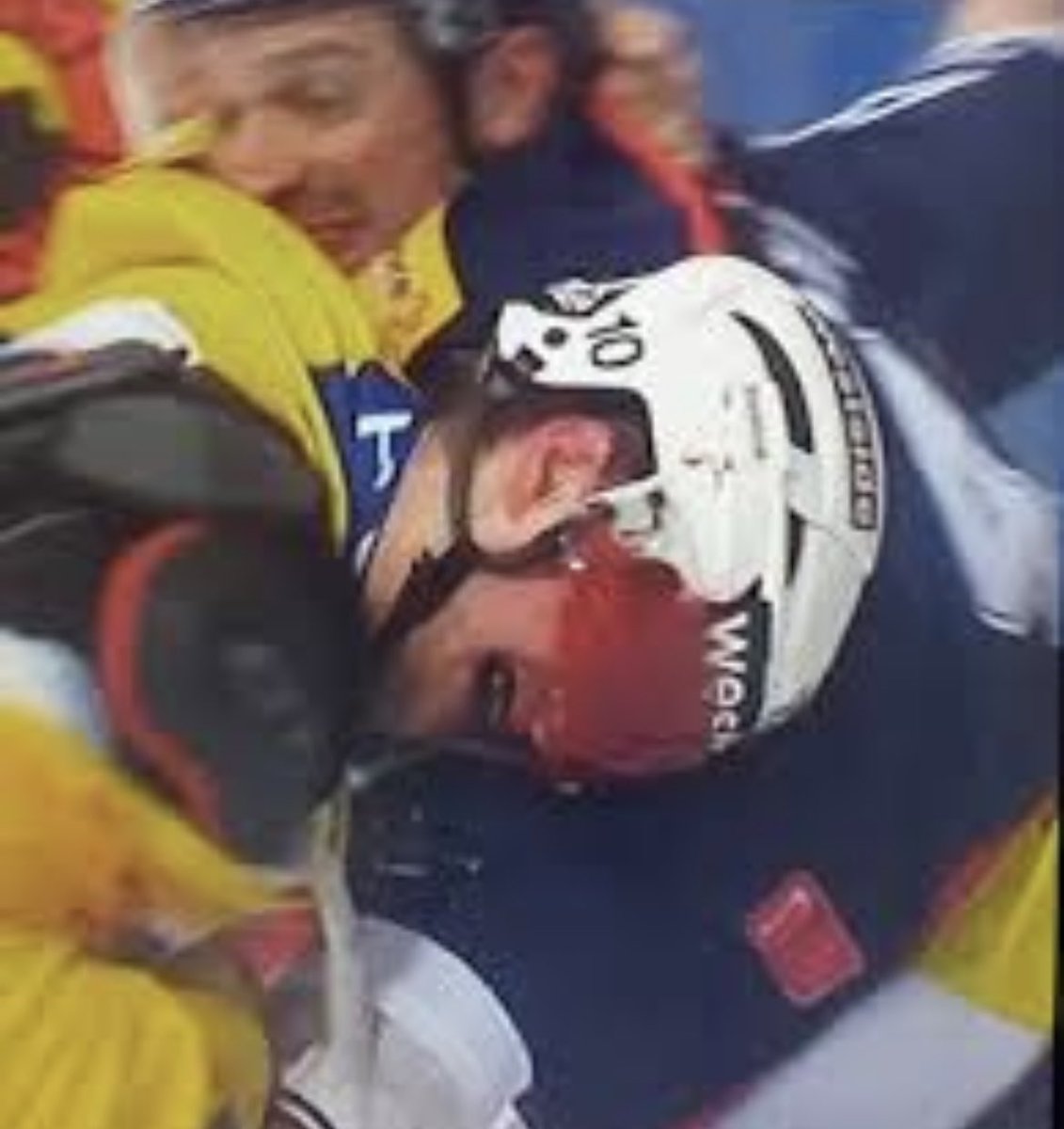 LAgustoni's tweet photo. Buon risveglio Tristan 😂 #hcap https://t.co/P5KjOdxdJx