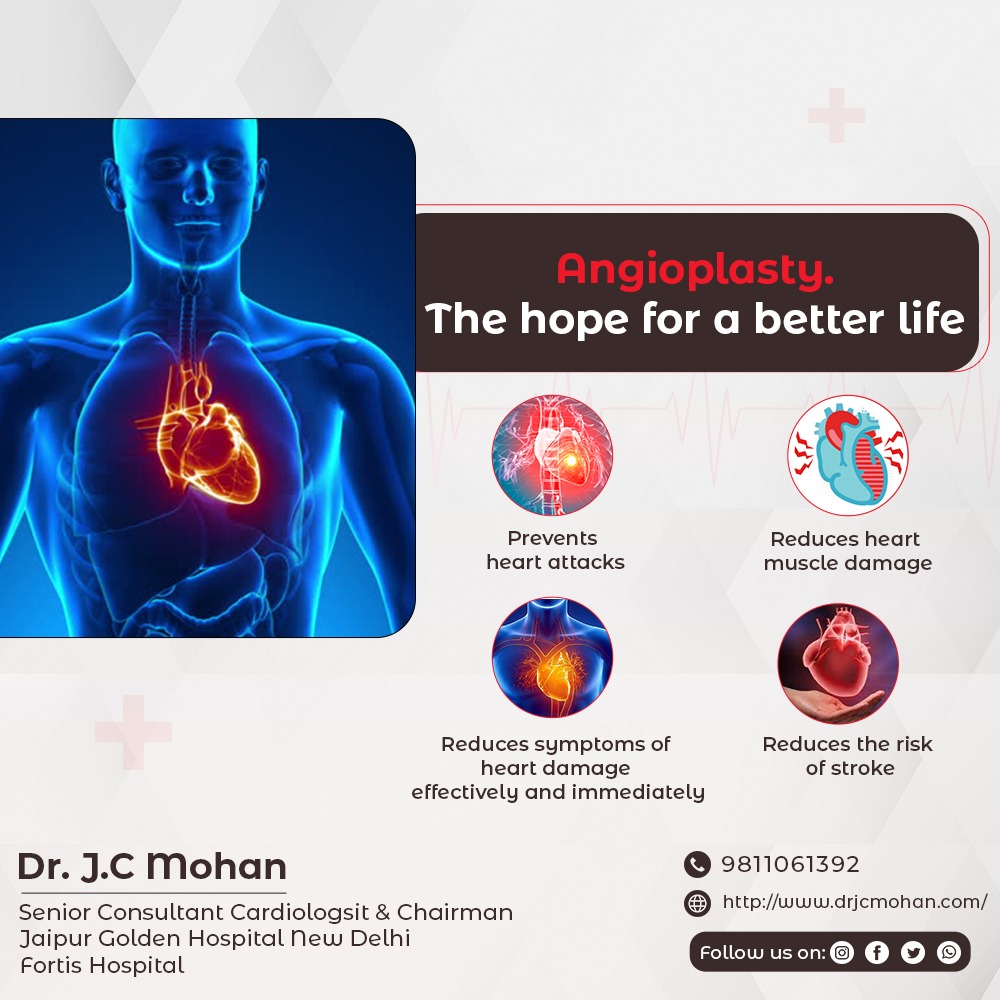 Dr_JCMohan's tweet photo. This advantageous procedure can be life-saving at the time of emergency.

#angiplasty #angigram #heatrtdisease #cardiologist https://t.co/dcGZd8QN0j