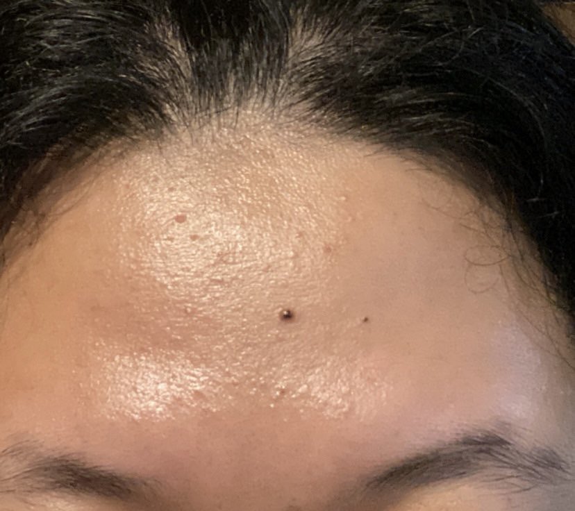 sukaskincarean's tweet photo. Tips mengurangi bruntusan ✨

a thread https://t.co/uHH7ET4XpI