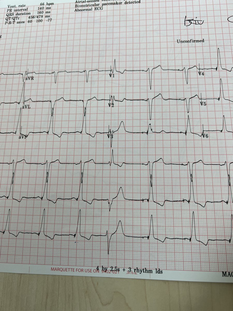 Interesting beat 👀