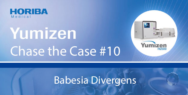 horibamedical's tweet photo. The 10th #ChaseTheCase is available now! This issue talks about severe #babesiosis due to Babesia divergens acquired in the United Kingdom. Yumizen H2500 #hematology analyzer plays an important role for such cases. Download & scubscribe👉 https://t.co/fU9ZovvomO @HORIBA_UK https://t.co/h72tnjkVjT