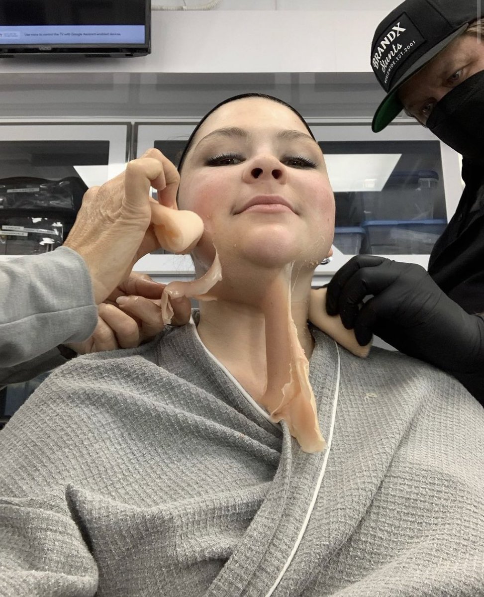 Thisispearson's tweet photo. The #ThisIsUs make-up team is something else!! Hannah [Teen Kate] didn’t have to take some weight. Prosthestics were put all over her face. Incredible, right? https://t.co/ZsD23Gqmw7